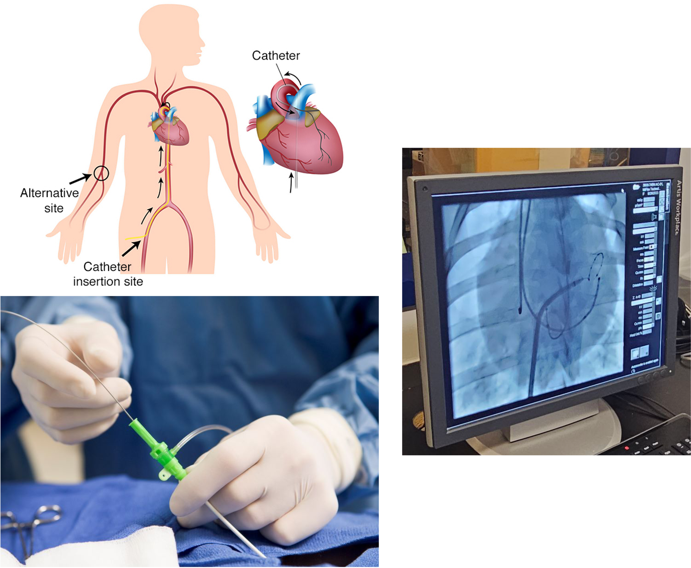 Medical Robotics Catheter Navigation Illustration